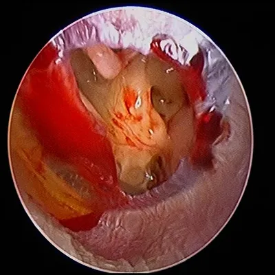 Diagnostic endoscopy camera and screen setup at Elite Health Care Surat