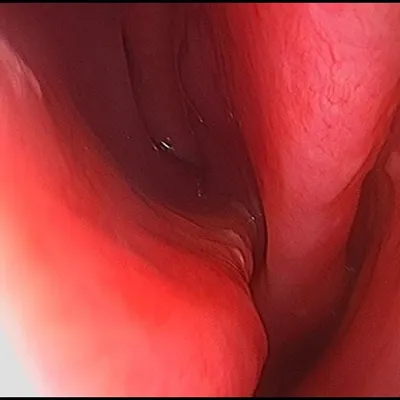 Diagnostic endoscopy camera and screen setup at Elite Health Care Surat