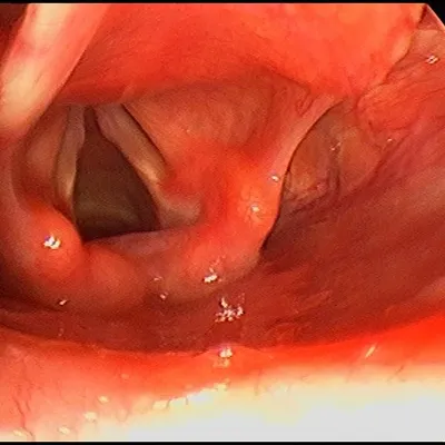 Diagnostic endoscopy camera and screen setup at Elite Health Care Surat