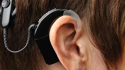 Ear surgery clinical details and operation setup at Elite Health Care Surat